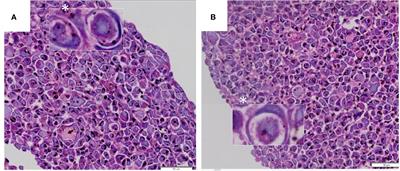 Cell-in-Cell Events in Oral Squamous Cell Carcinoma